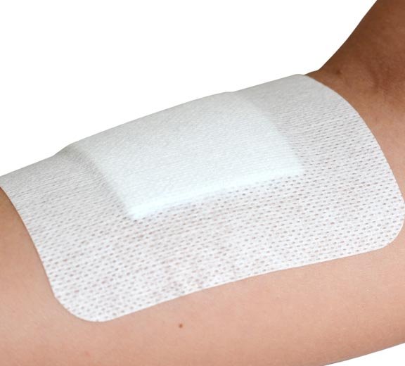 Image of Softpore Adhesive Island Dressing