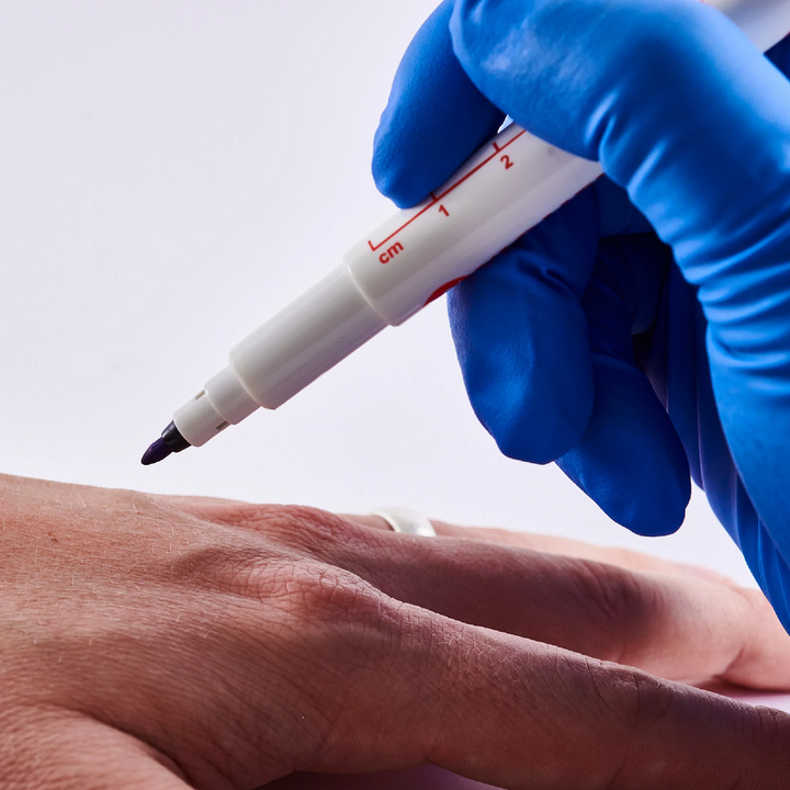 Viomedex Surgical Skin Marker Pen