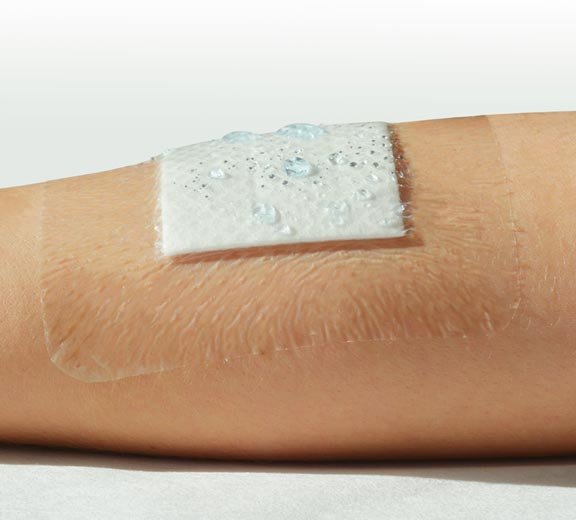 Image of Clearpore Transparent Post-Operative Dressing